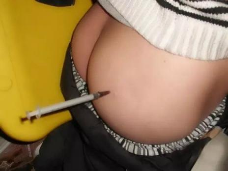 一些老图打针图片屁股好看[18P]