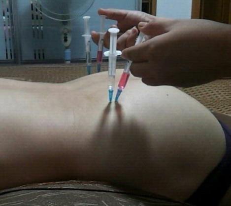 一些老图打针图片屁股好看[18P]