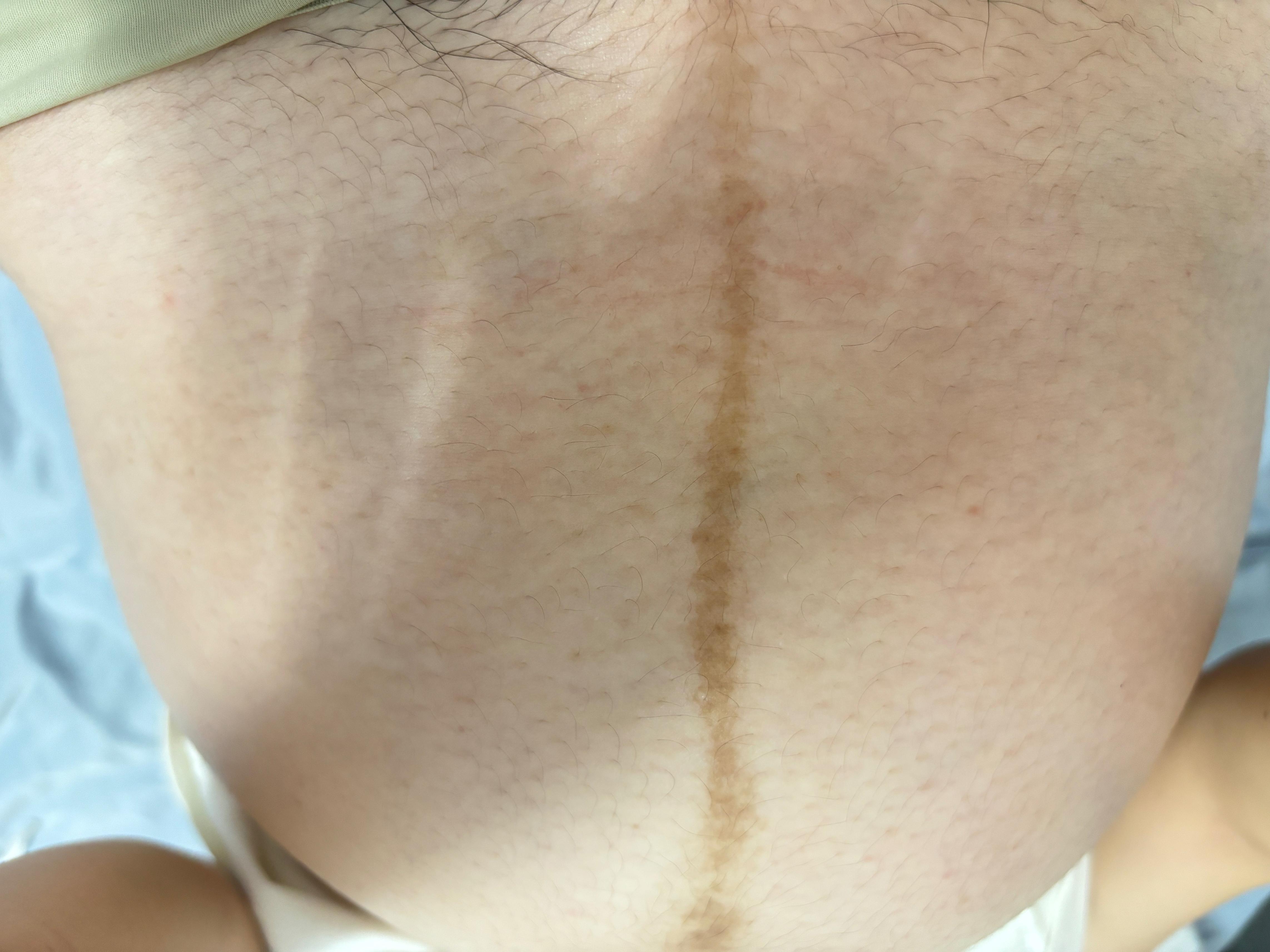 22岁骚货孕妇顺产，骚穴被剪开恢复全过程[22P]