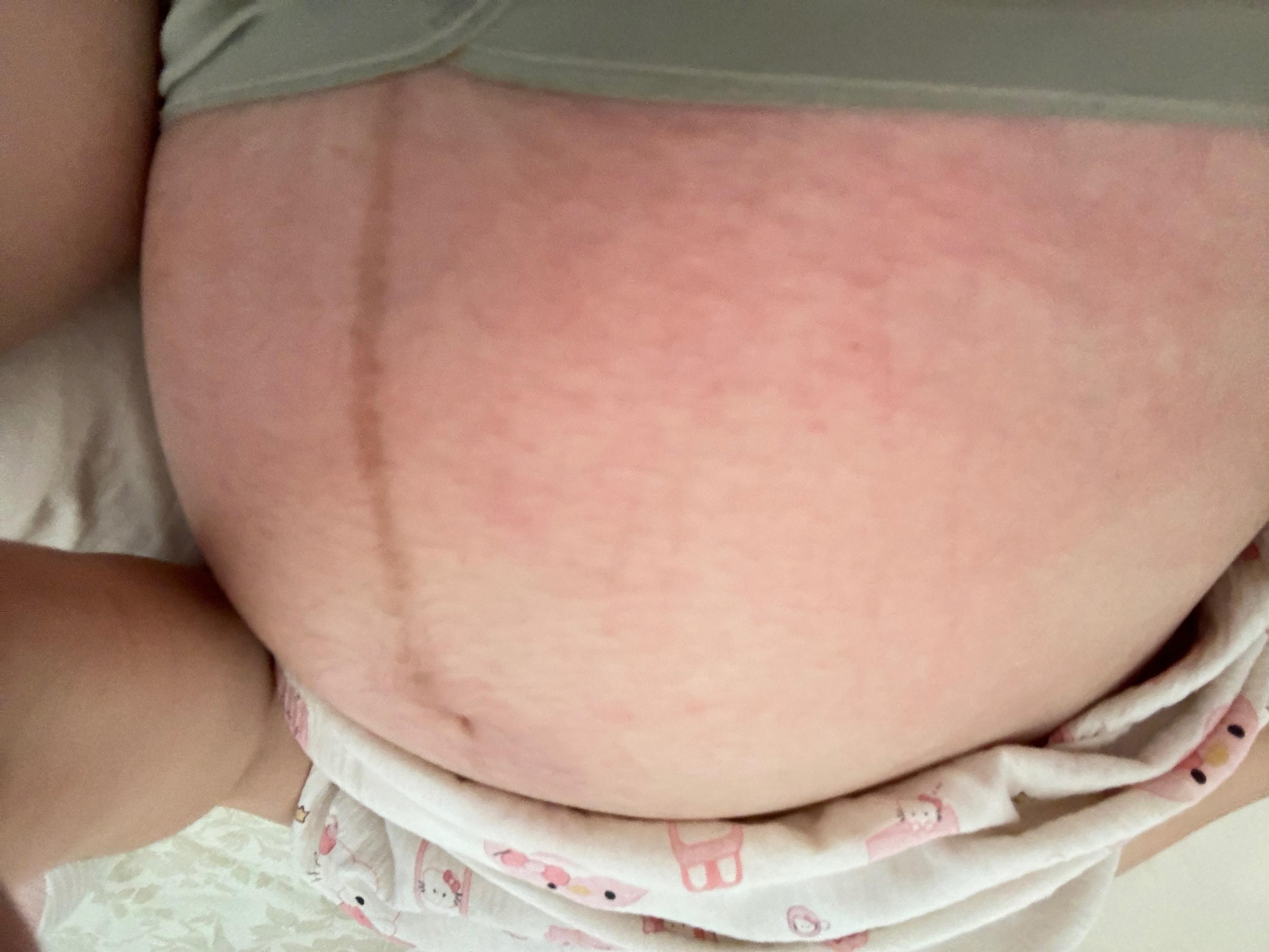 22岁骚货孕妇顺产，骚穴被剪开恢复全过程[22P]